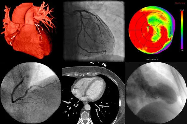 Image from article showing different cardiac imaging modalities. credit: iStock